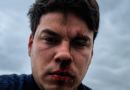 Vereador polêmico é agredido durante fiscalização em área de alagamentos em Navegantes