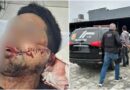 Homem é preso em Navegantes suspeito de decepar dedo após atropelamento de cão